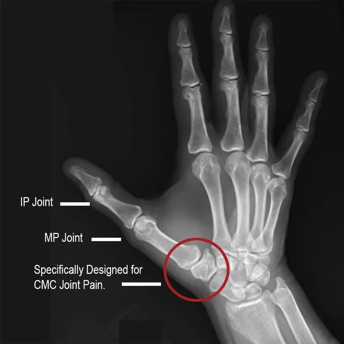 Comfort Cool Thumb CMC Restriction Splint - Australian Assistive Technology Centre