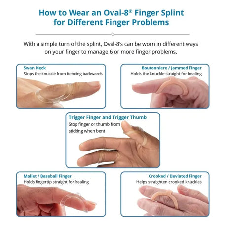 3pp® Oval-8® Finger Splints - Australian Assistive Technology Centre